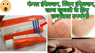 Lobate Gm Cream खज-खजल,फगल ओर सकन इनफकशन,सजन क लए जबरदसत