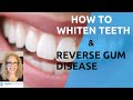 HOW TO WHITEN TEETH & Reverse Gum Diseases | NATURALLY!