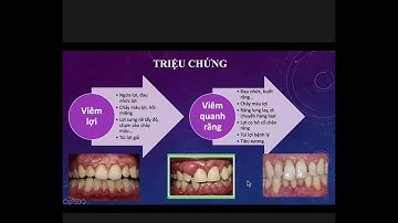 LÂM SÀNG BỆNH QUANH RĂNG