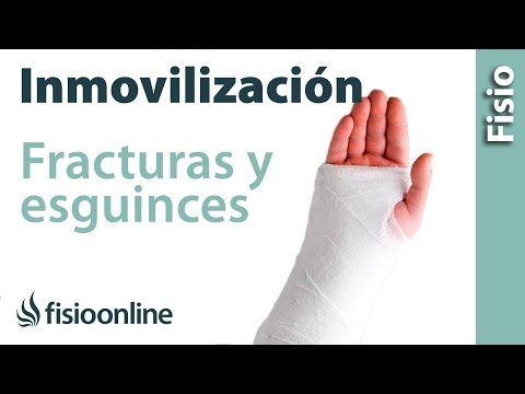 Vídeo: Férulas En El Antebrazo: Síntomas, Causas Y Más