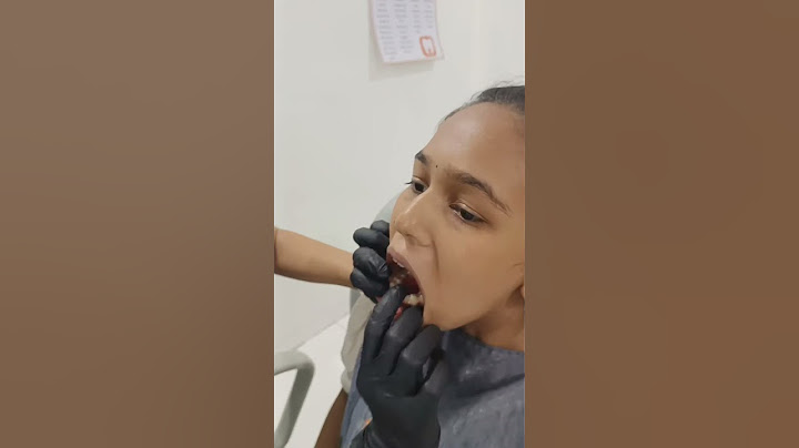 Delivering Clear Retainers | Best Dental Hospital In India | @EledentDentalHospitals #shorts
