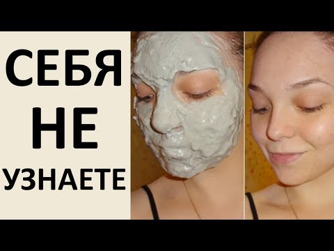 Маски Для Лица Которые Буквально МЕНЯЮТ ЖИЗНИ?
