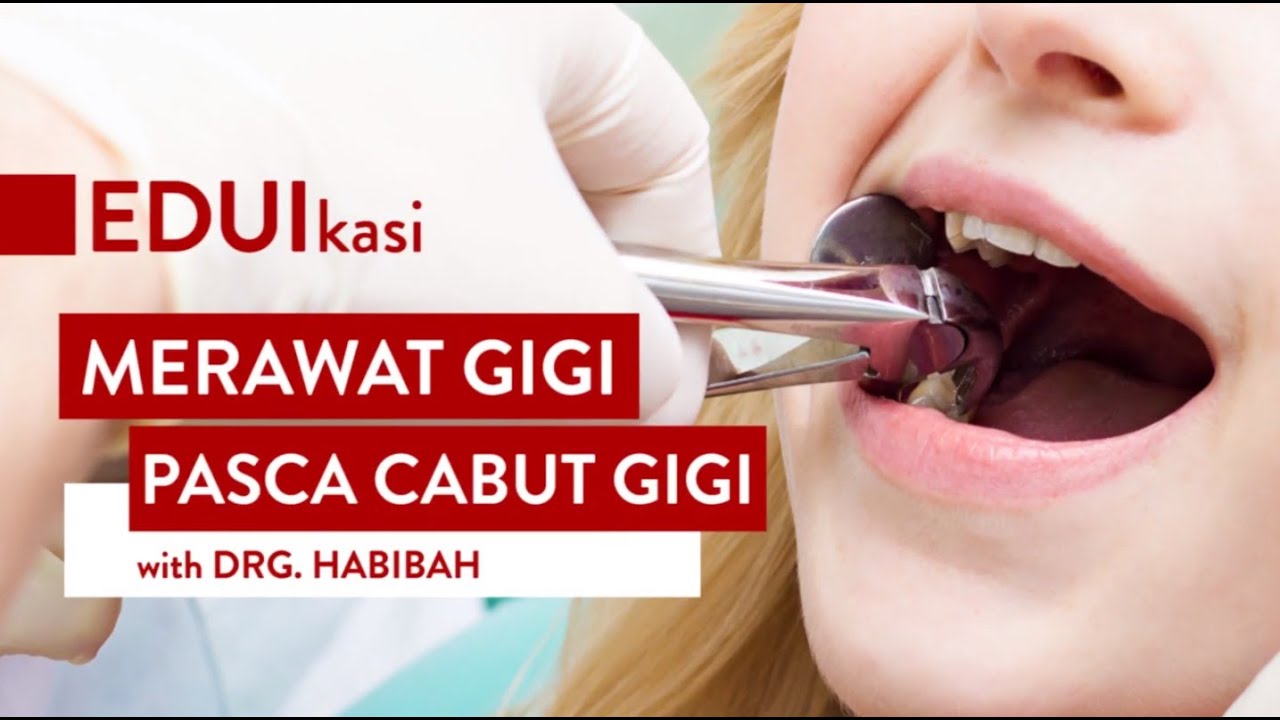 Cara Mudah Perawatan Gigi Habis Dicabut Agar Cepat Pulih