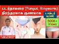     home remedies  foods  how to cure ringworm permanently  tamil