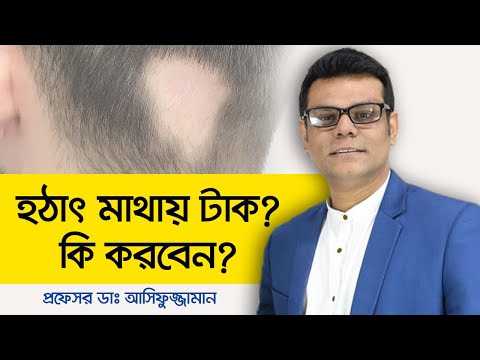 ভিডিও: কীভাবে টাক পড়া রোধ করবেন?