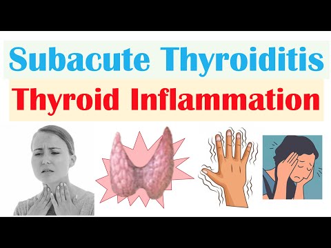 Subacute Thyroiditis (Thyroid Inflammation; De Quervain’s) | Causes, Symptoms, Diagnosis, Treatment