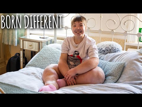 The Teen With The Swollen Body | BORN DIFFERENT