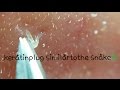 鼻角栓連続ぬき I pull out keratinpkug continiously.