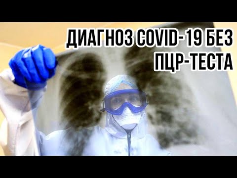 Врачи могут устанавливать диагноз «COVID-19» без ПЦР-теста #shorts