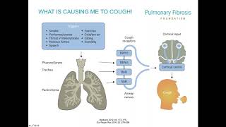 Cough 101: An Overview of Cough in Pulmonary Fibrosis