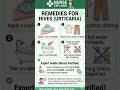 Stop the Itch! 5 Fast Home Remedies for Hives Urticaria 🌡️🧴 #shorts