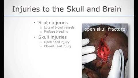 EMT 37 Head Neck and Spinal Injuries