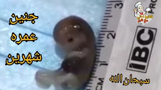 جنين عمره شهرين فقط شاهد حجمه هل من قائل سبحان الله