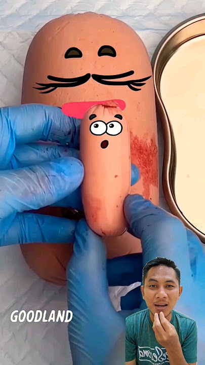 sosis melahirkan😅