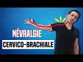 TRAITEMENT DE LA NÉVRALGIE CERVICO BRACHIAL :  EXERCICE KINÉ