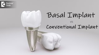 Comparison between basal and Conventional Implants  Dr. Shahul Hameed|Doctors' Circle