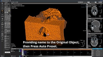 Segmentation of the Maxillary Sinuses.