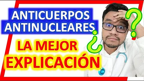 ¿Es positivo el factor reumatoide en la esclerodermia?