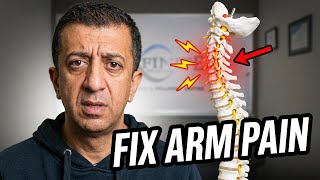 Cervical Stenosis Causing Arm Pain? Try These 5 Stretches