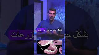 لماذا تفشل زراعة الأسنان؟ أسباب يجب عليك معرفتها