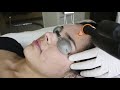 Scar  laser treatment