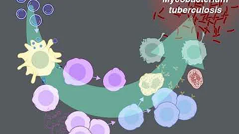 Preventing Tuberculosis