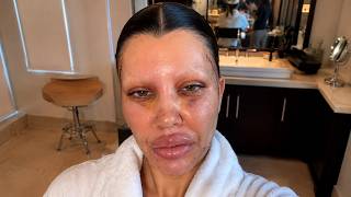 What The HELL Happened To These Celebrities