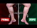 Come migliorare la circolazione delle gambe (in soli 3 minuti al giorno!!!)