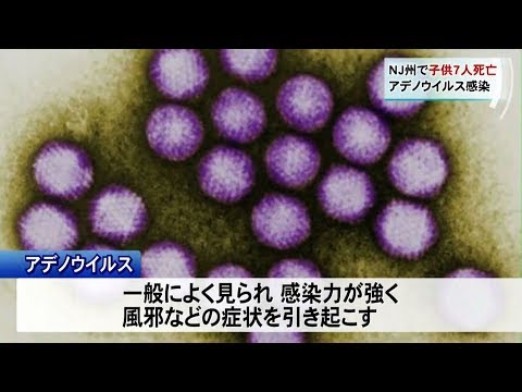 症状 子供 ウイルス アデノ 繧｢繝�ヮ 繧ｦ繧､繝ｫ繧ｹ