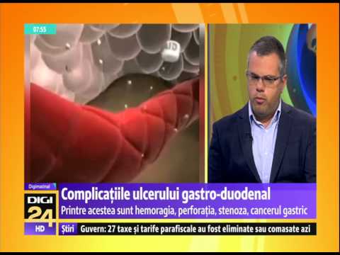 Video: Diferența Dintre Duoden și Jejunum