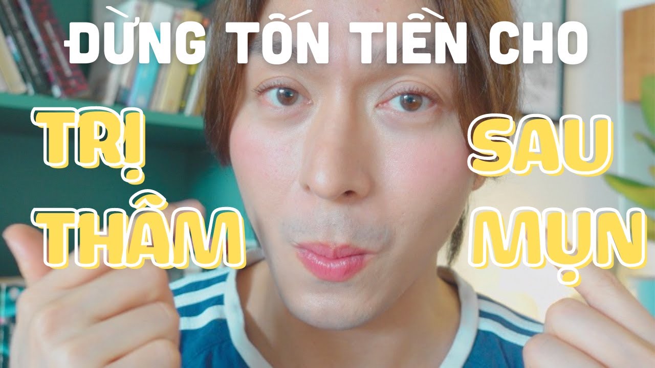 Outline Video CÁCH TRỊ THÂM MỤN - RẤT ĐƠN GIẢN, DỄ DÀNG, KHÔNG CẦN TỐN KÉM | Kỳ Kỳ
