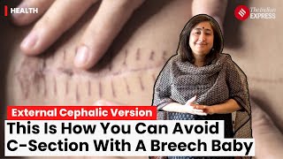 Breech Baby: Vaginal Birth Possible For Babies Positioned Feet Or Bottom First In Uterus