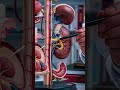 Is MRI Really Necessary? Sonography vs MRI Explained | Dr. Priyadatt Patel #shorts