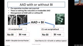 DECODING the Cranio-vertebral junction- creating strategy for surgery for basilar invagination & AAD screenshot 2