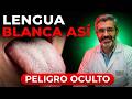 TIENES la LENGUA BLANCA y ESTE ÓRGANO está en riesgo