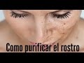 COMO PURIFICAR EL ROSTO