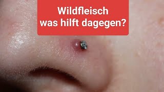 ❗Wildfleisch Am Piercing❗Wir Sagen Dir Was Du Dagegen Tun Kannst, Und Wie Du Es Am Besten Los Wirst