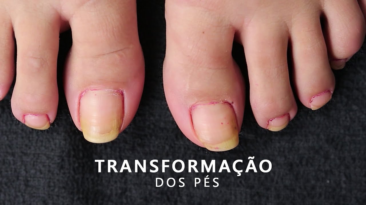 Transformação dos pés -  Pedicure do dia