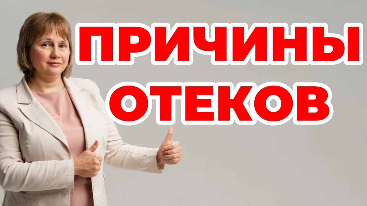 Причины отеков.  Что проверить. Доктор Лисенкова 