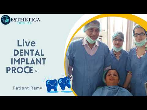Revitalize Your Smile: Live Dental Implant Solutions in Tricity Area