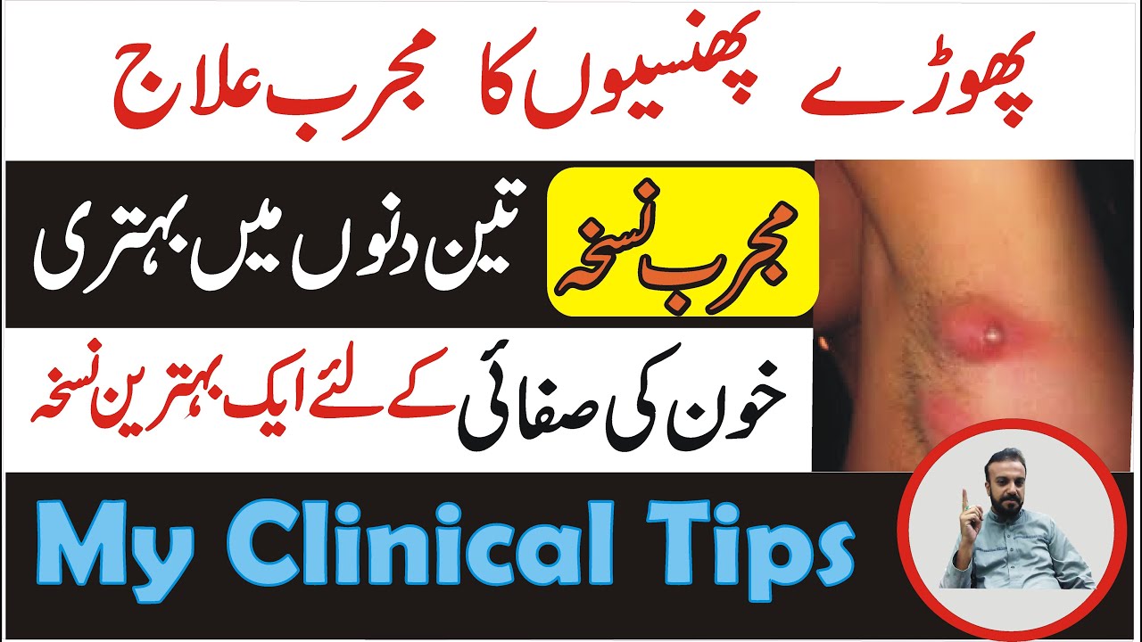 Phoray Phunsi Ka Homeopathic Treatment Phoray Phunsi Ka Ilaj In 