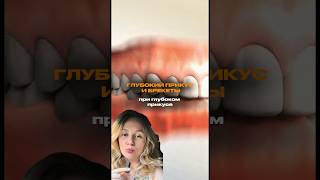 #ортодонт #ортодонтическоелечение #брекеты #неправильныйприкус #брекетымосква #стоматологмосква