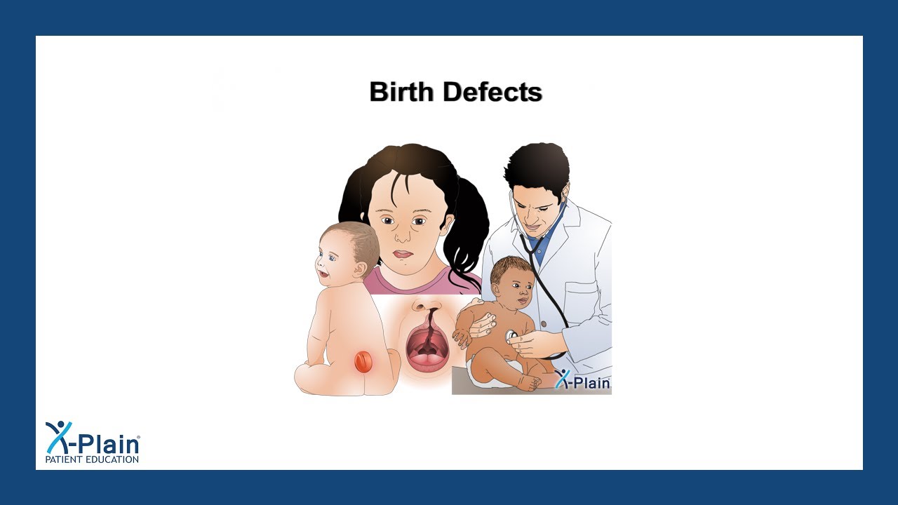 Defective Child Birth