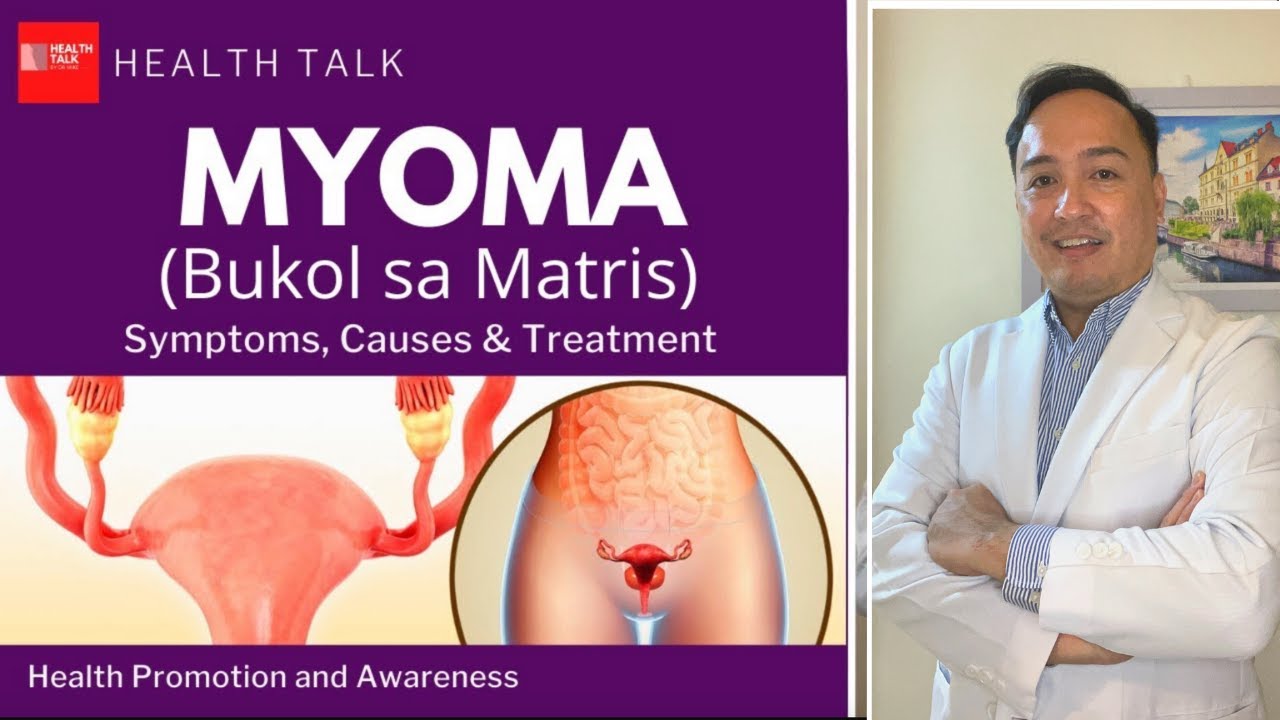 Myoma or Bukol sa Matris