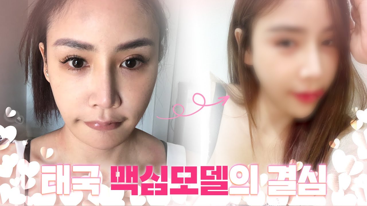 [Эйтоп гоо сайхны мэс засал] Солонгост гоо сайхны мэс засал хийлгэсэн Максим моделийн түүх