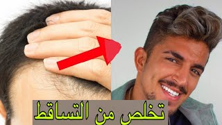 عشر شغلات بتخلي شعرك يصير كثيف || حل مشكلة تساقط الشعر