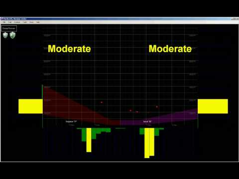 Video MERLIN Bird Radar Strike Alert Display