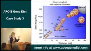 Stroke - Apoe Gene Case Study  3