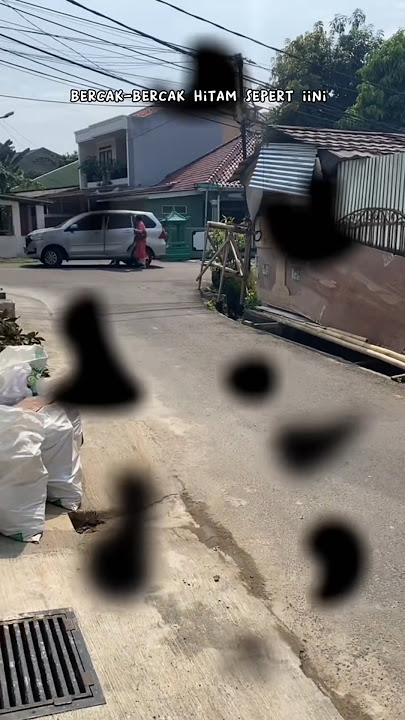 Hati2⚠️ Penglihatan bercak2 hitam dan berbayang ini bisa menyebabkan resiko kebutaan 😱