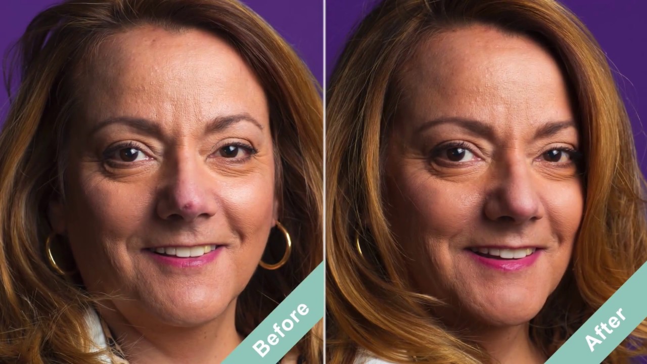 Best Scar Filler Makeup Dermaflage Conceals Scars Intantly YouTube